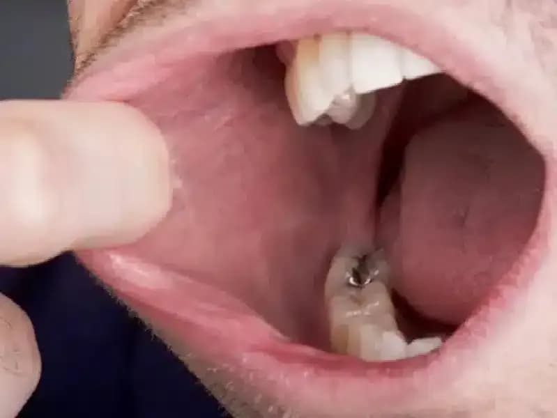 diagnosis-of-oral-cancer.4.webp