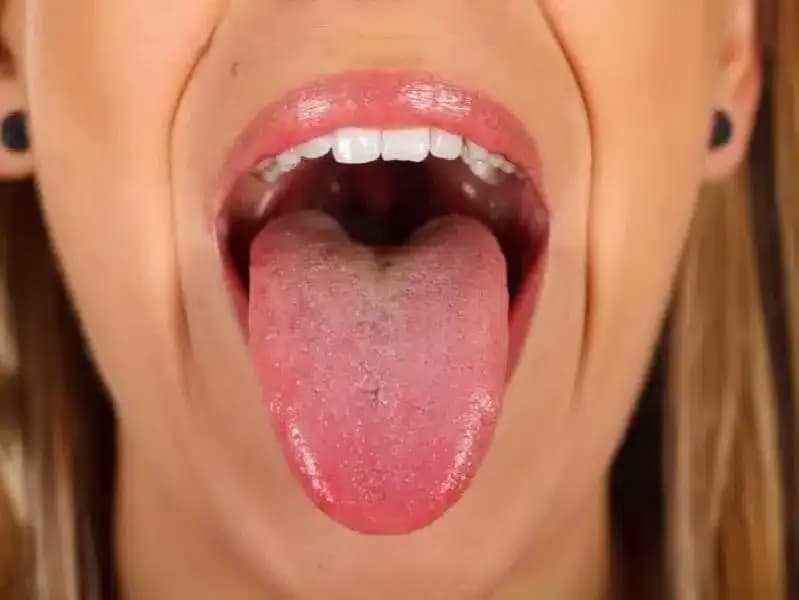 diagnosis-of-oral-cancer.5.webp