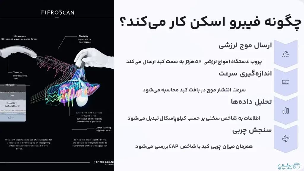 fibroscan.1-1024x576.webp