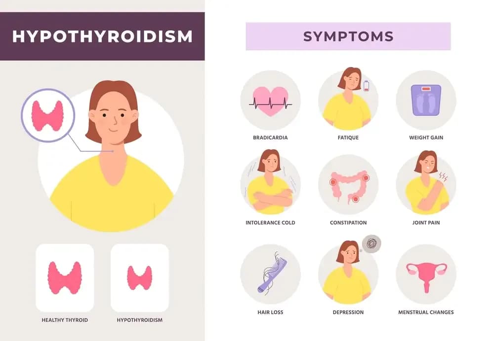 hypothyroidism.webp