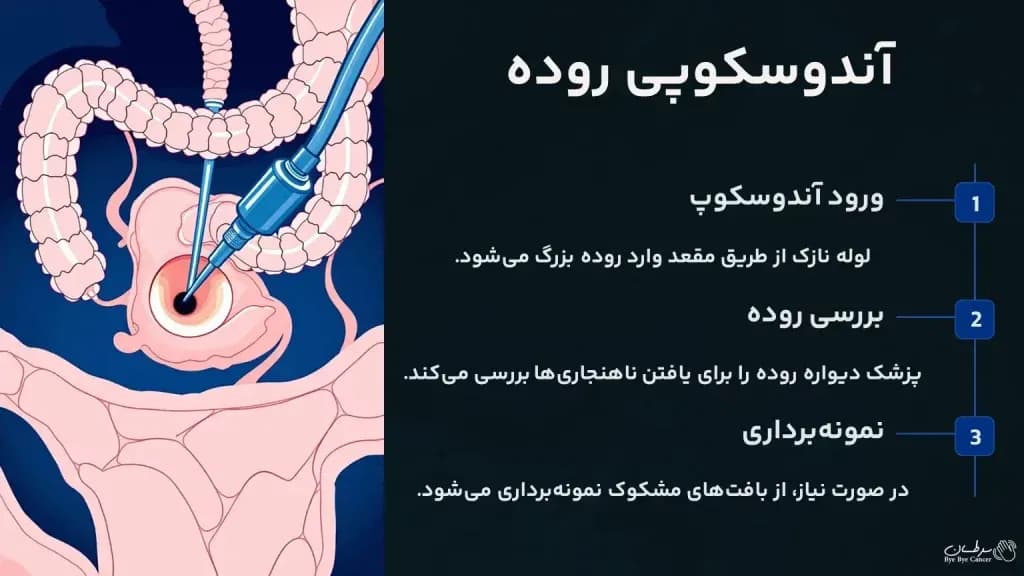 intestinal-endoscopy-1024x576.webp