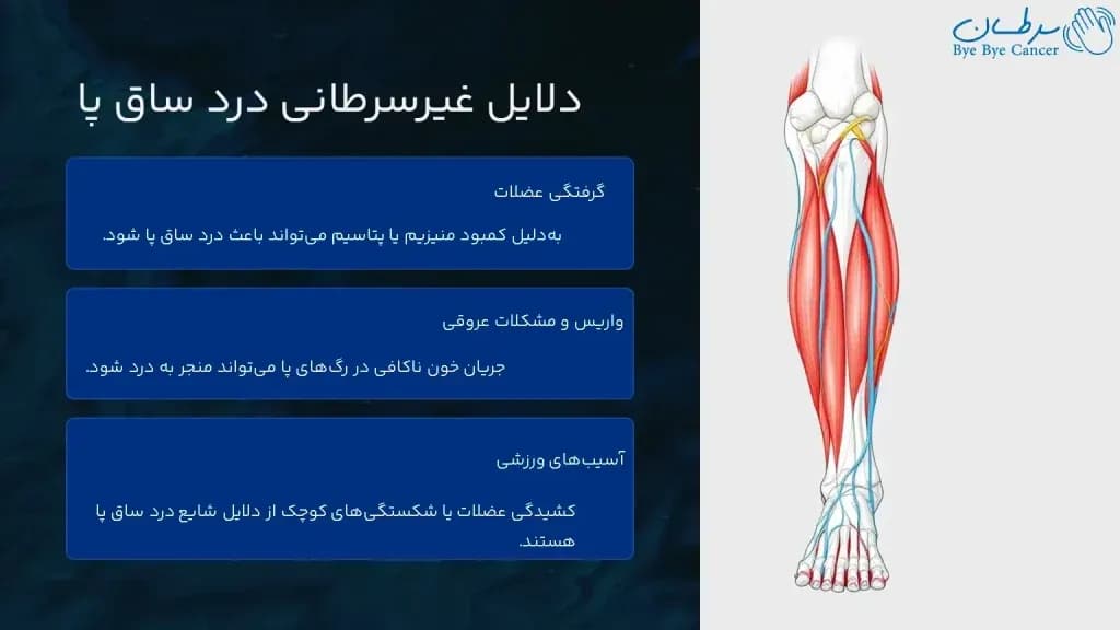 leg-pain.3-1024x576.webp