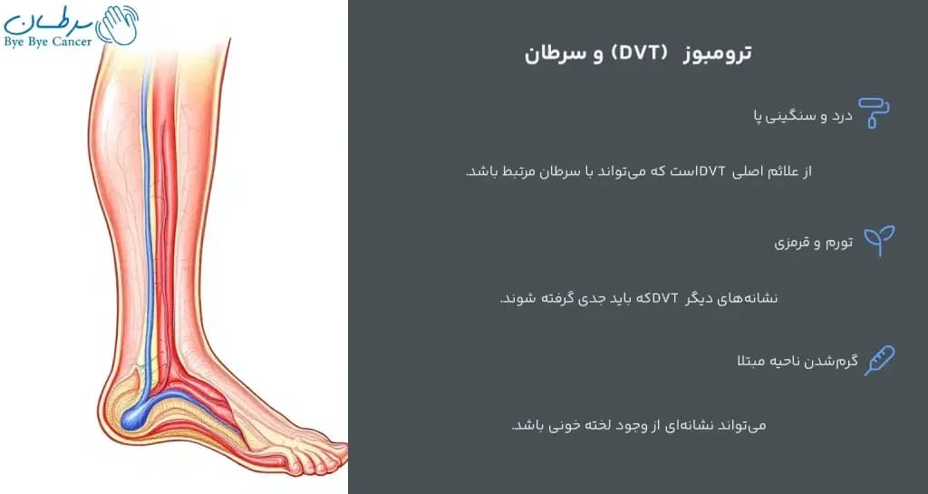 leg-pain.4-1024x545.webp