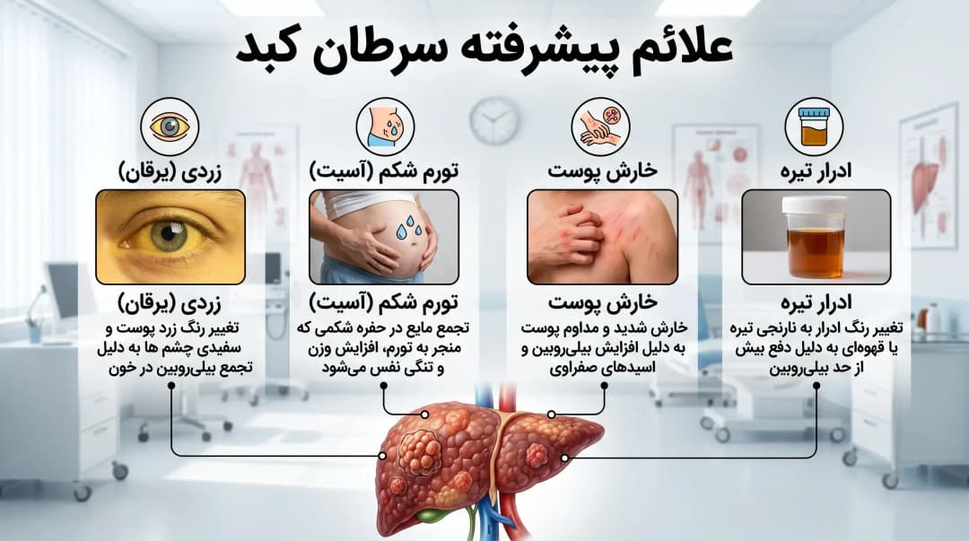 علائم و تشخیص سرطان کبد