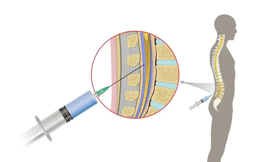 lumbar-hole.1.webp