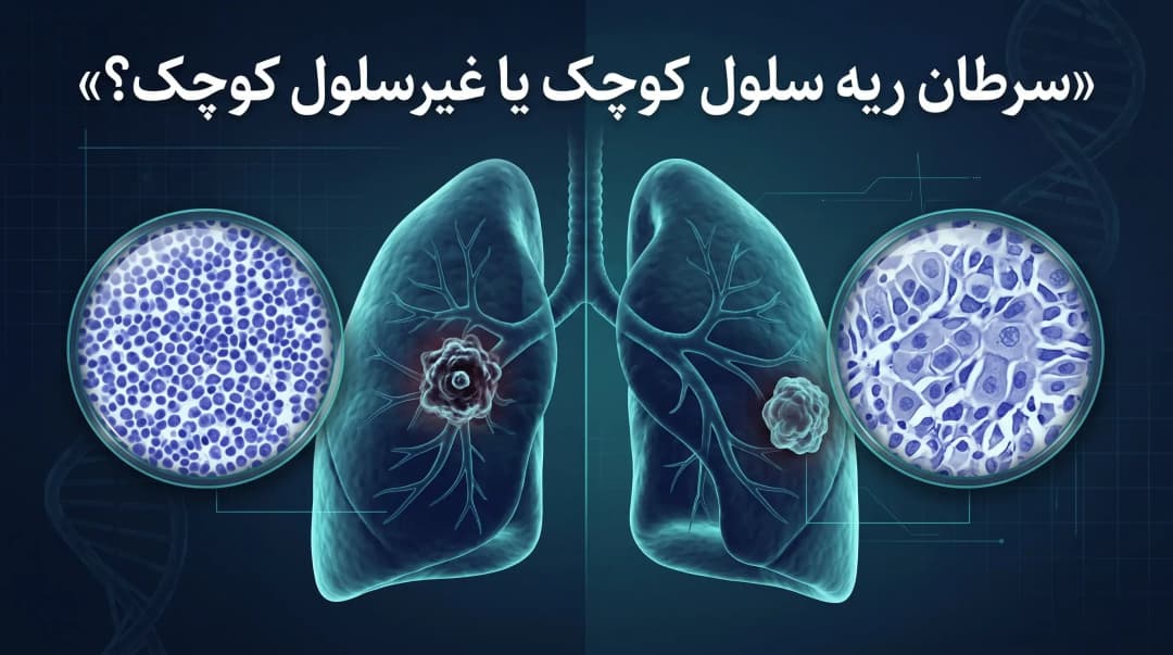 تفاوت سرطان ریه سلول کوچک و غیرسلول کوچک