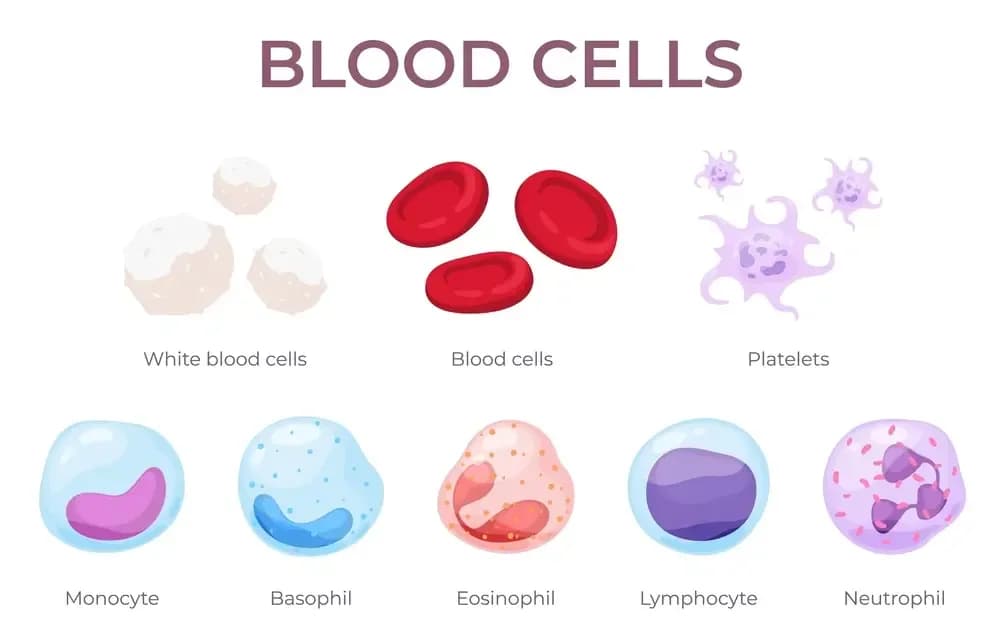 lymphoblastic.1.webp