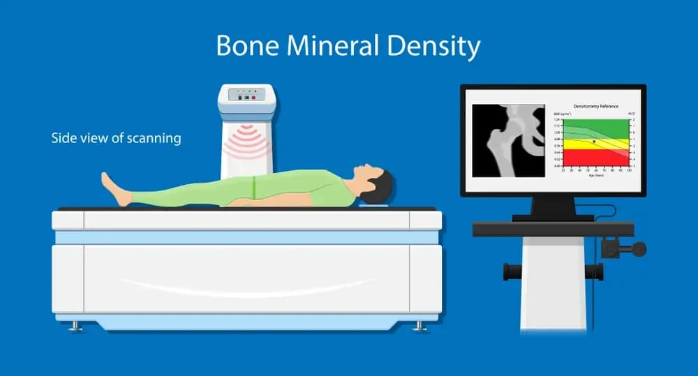maintain-bone-density.1.webp
