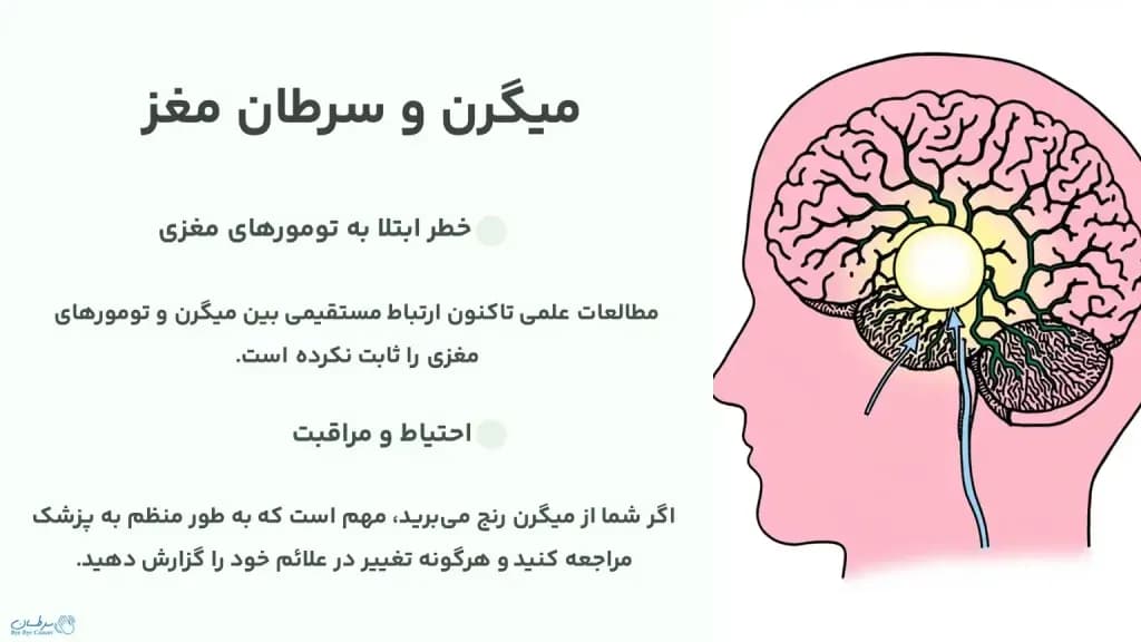 migraine-and-brain-cancer-1024x576.webp