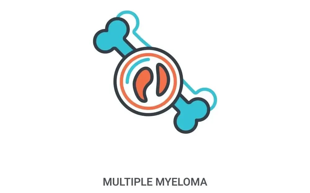 multiple-myeloma.1.webp