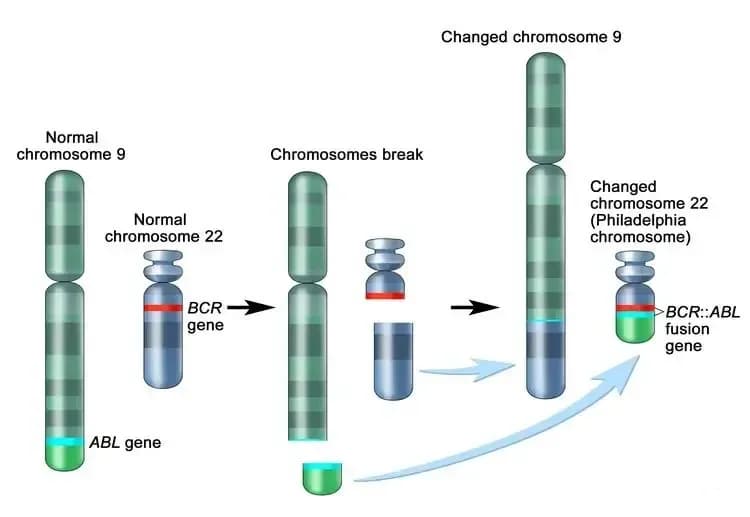 myeloid-leukemia.1.webp