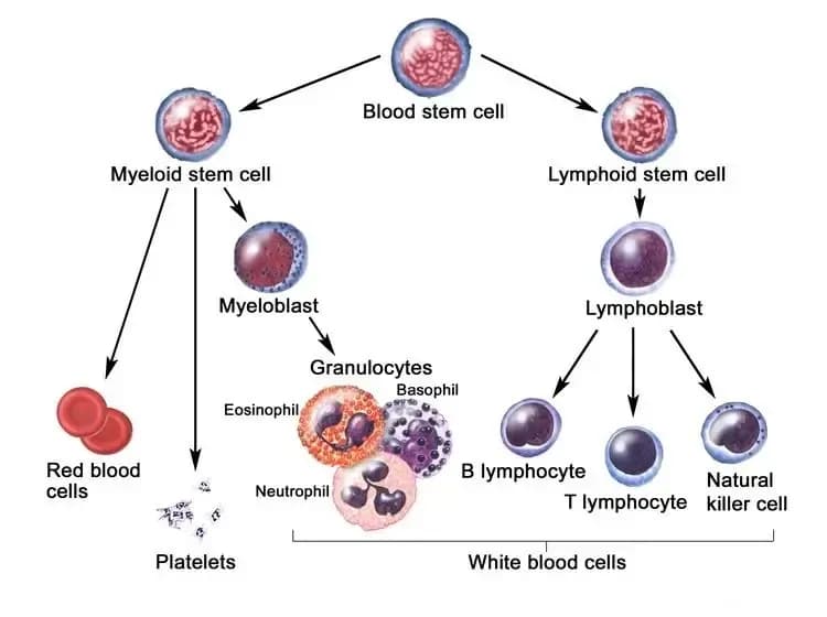 myeloid-leukemia.webp