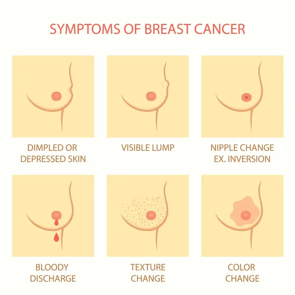 nipple-discharge.1.webp