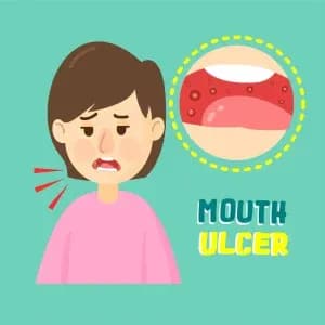 oral-ulcer-during-chemotherapy.1-300x300.webp