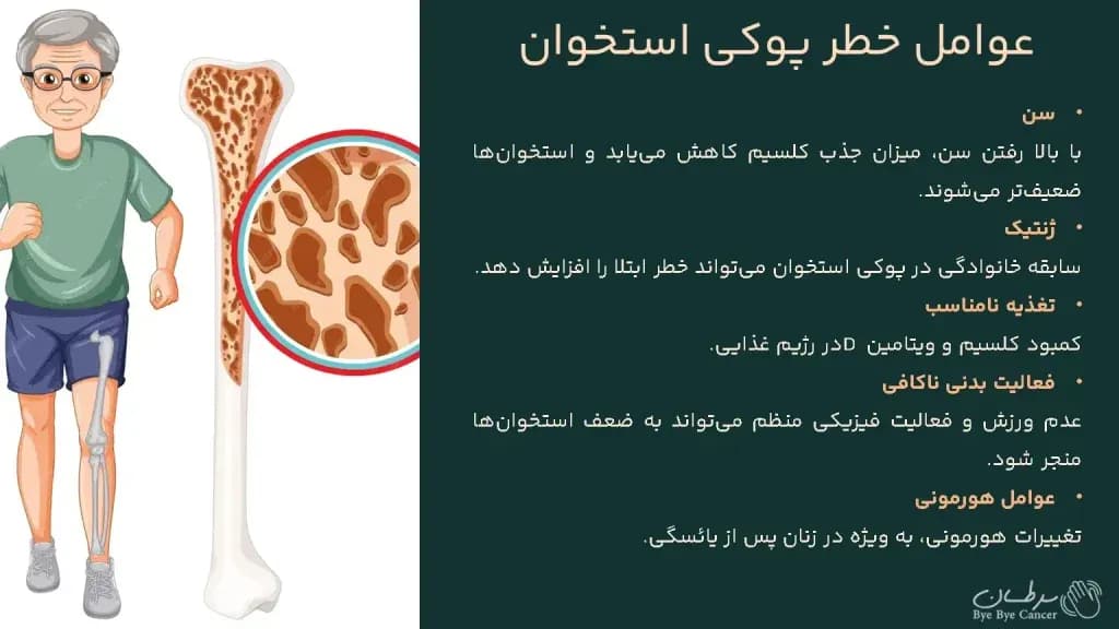 osteoporosis.2-1024x576.webp