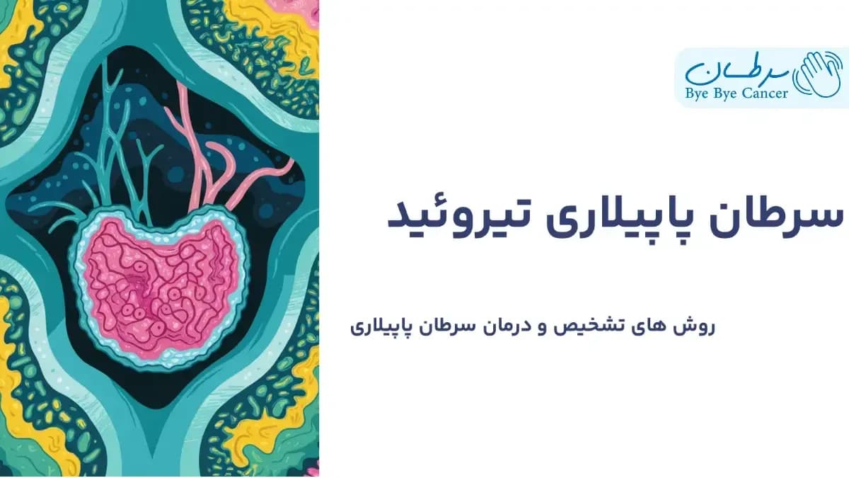 سرطان پاپیلاری