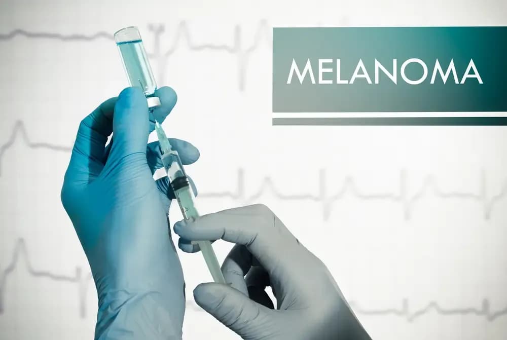 prevention-of-skin-cancer.1.webp