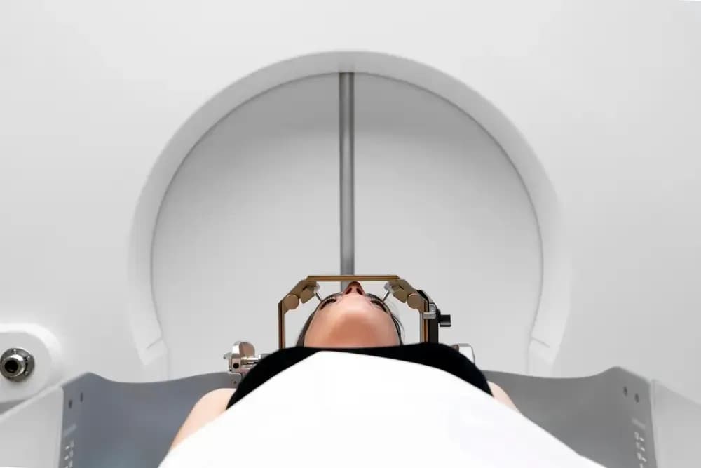 radiosurgery-technique.11.webp