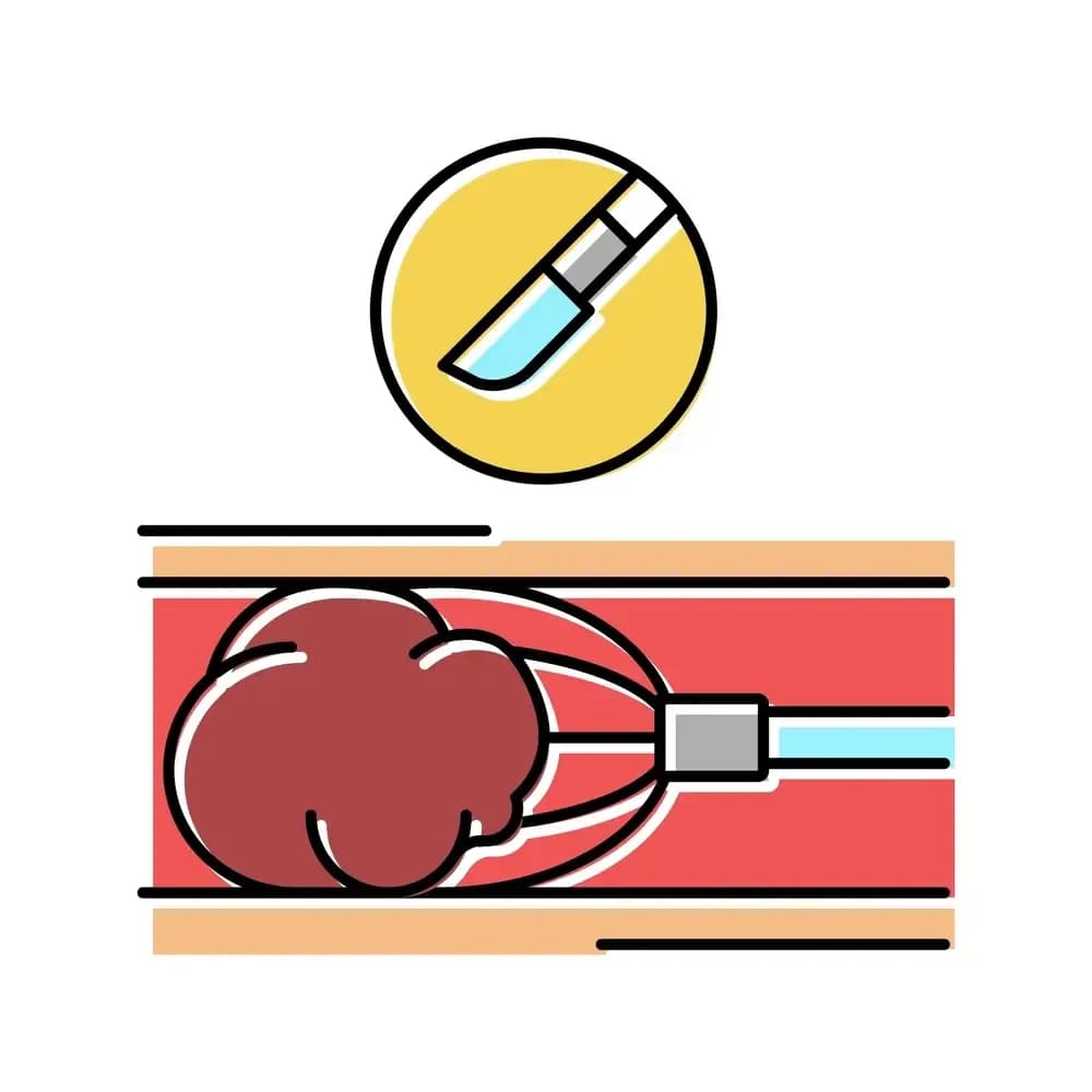 radiosurgery.1.webp