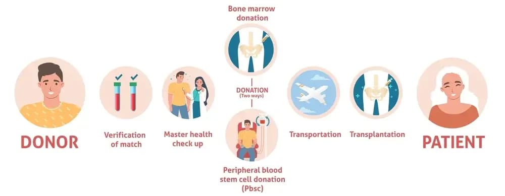 stem-cell-transplantation-for-the-treatment-of-leukemia.1.webp