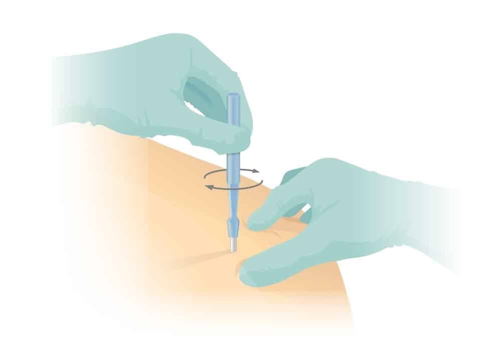 the-best-biopsy-doctor-in-tehran.1.jpg