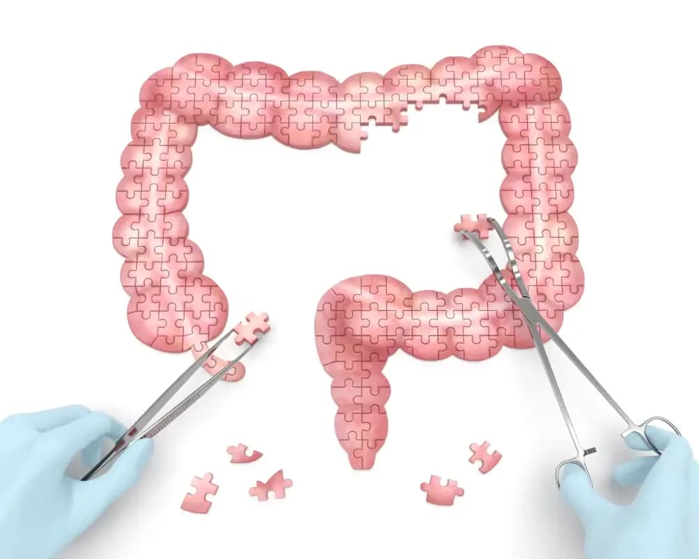 the-best-colon-cancer-surgeon-in-tehran.1.webp