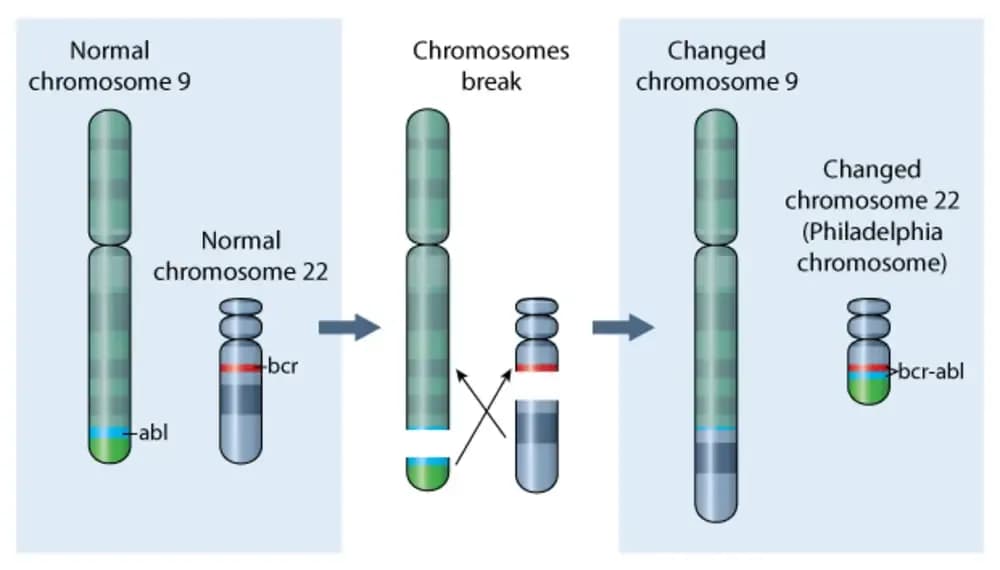 the-philadelphia-chromosome.2.webp