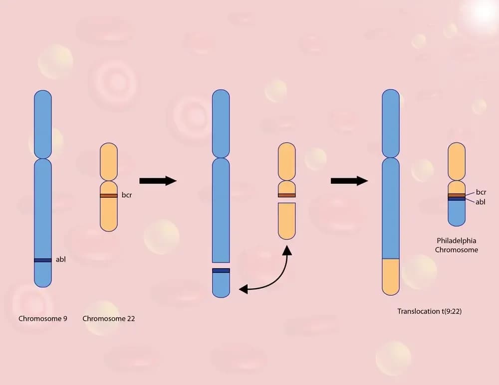 the-philadelphia-chromosome.3.webp