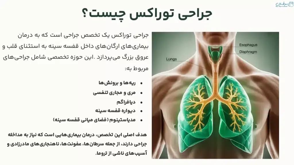 thoracic.1-1024x576.webp