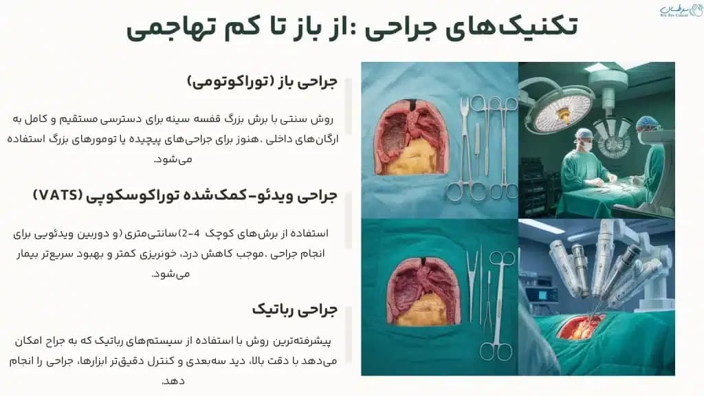 thoracic.3-1024x576.webp