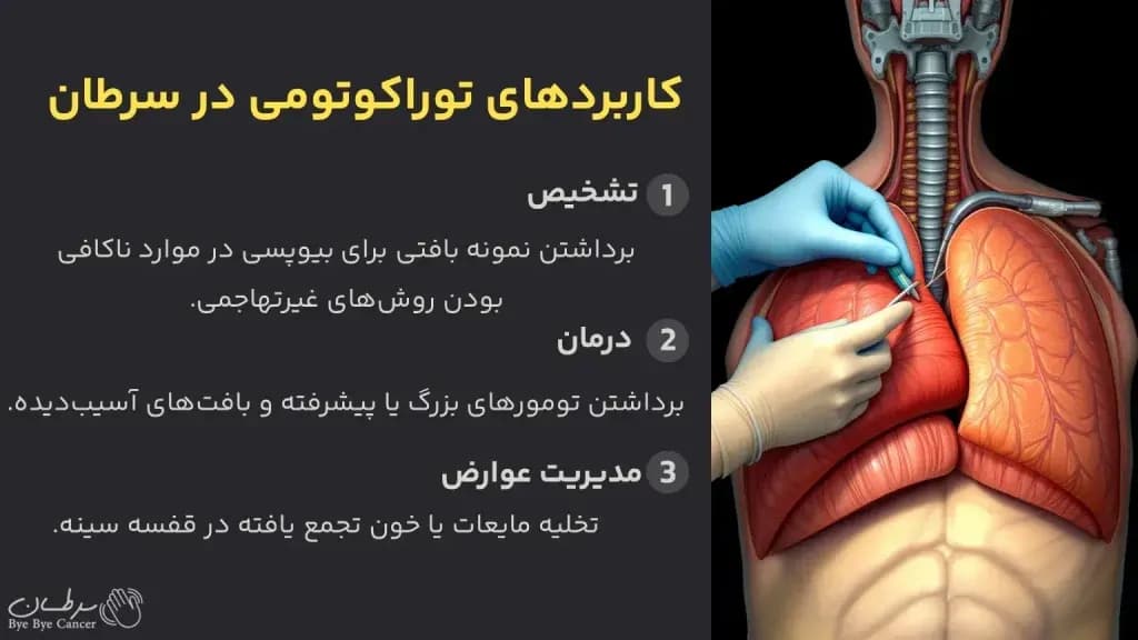 thoracotomy.2-1024x576.webp