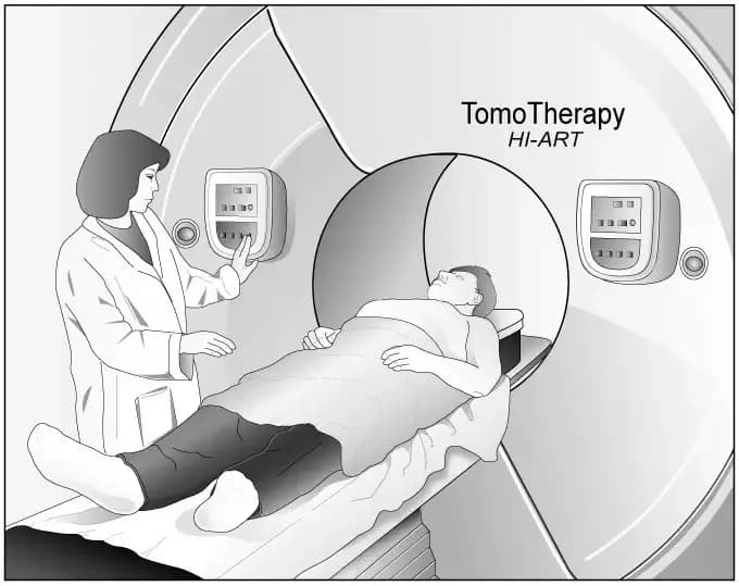 tomotherapy-device.webp