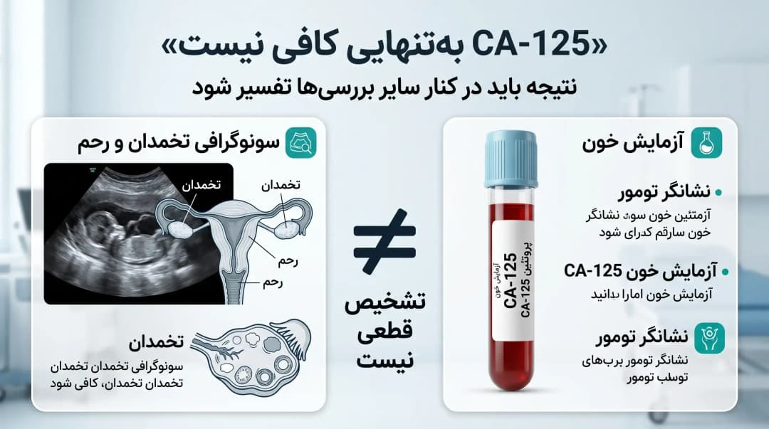 علائم مبهم سرطان تخمدان