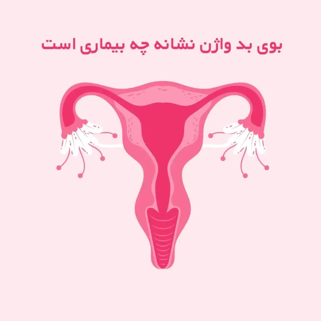 بوی-بد-واژن-نشانه-چه-بیماری-است-1024x1024.webp