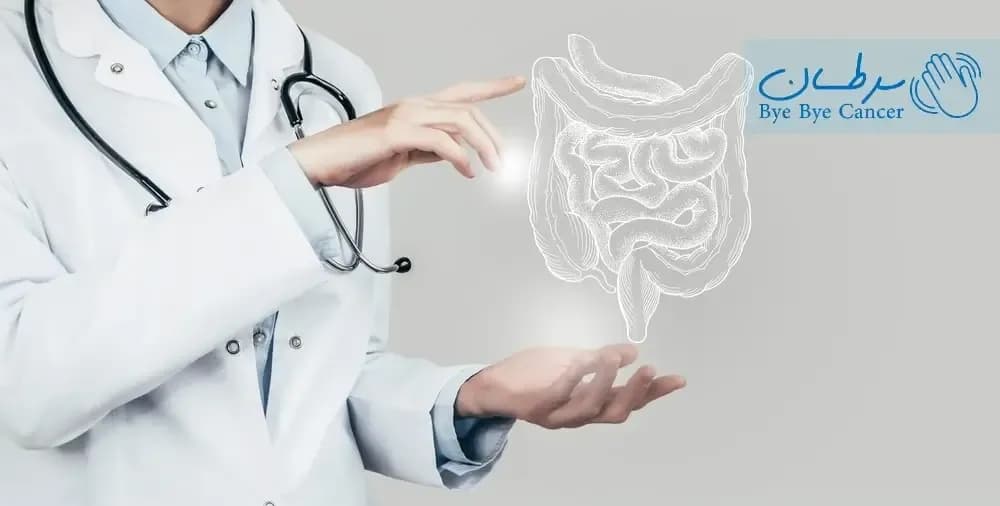 دکتر سرطان کولورکتال
