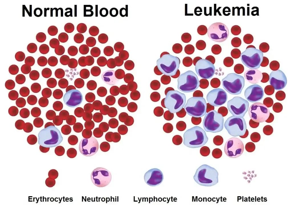 CML-cancer-control.1.webp