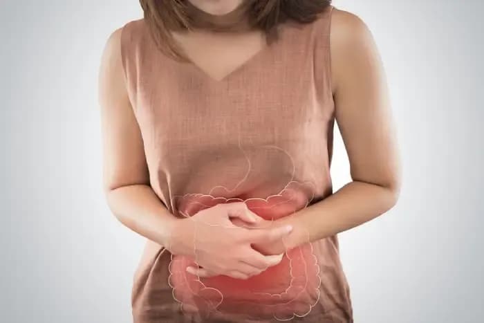 Colon-polyps.webp