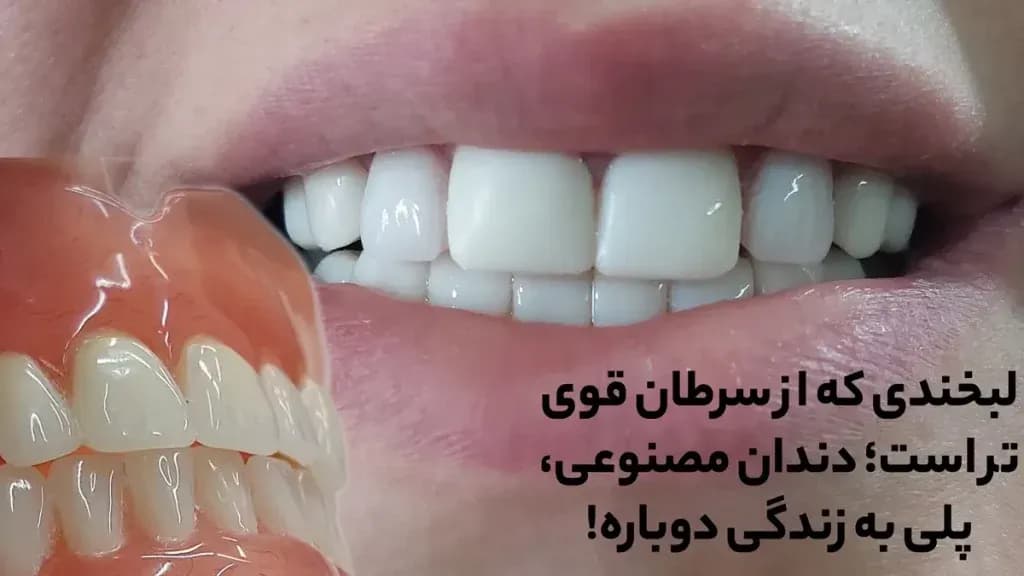 Denture-1024x576.webp