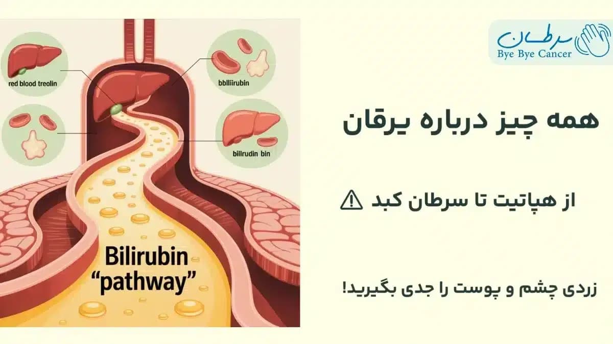 یرقان