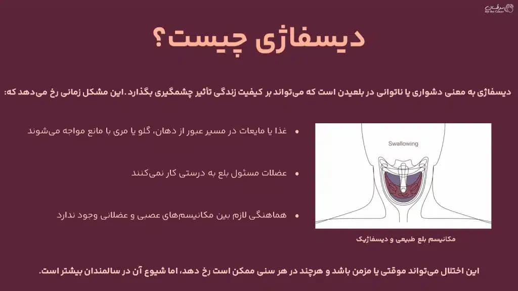 dysphagia.1-1024x576.webp