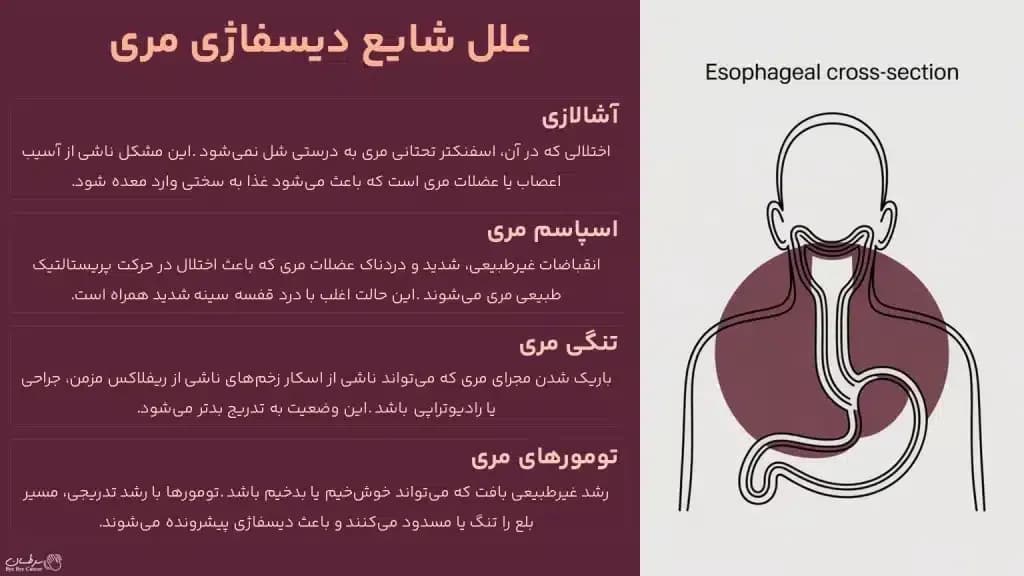 dysphagia.4-1024x576.webp