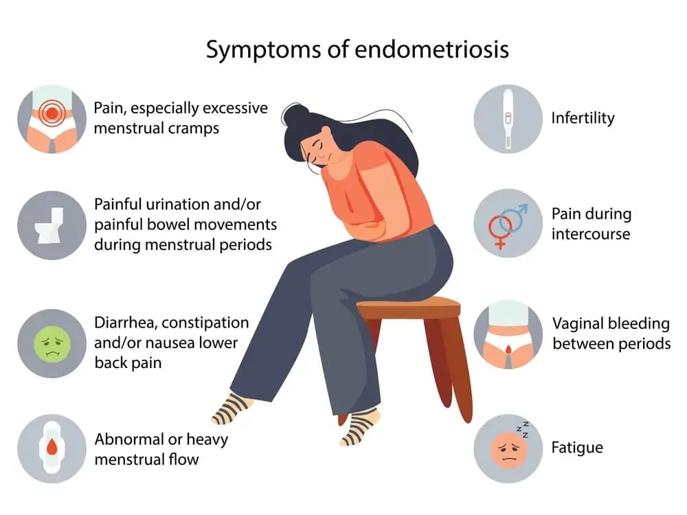 endometriosis-disease.webp