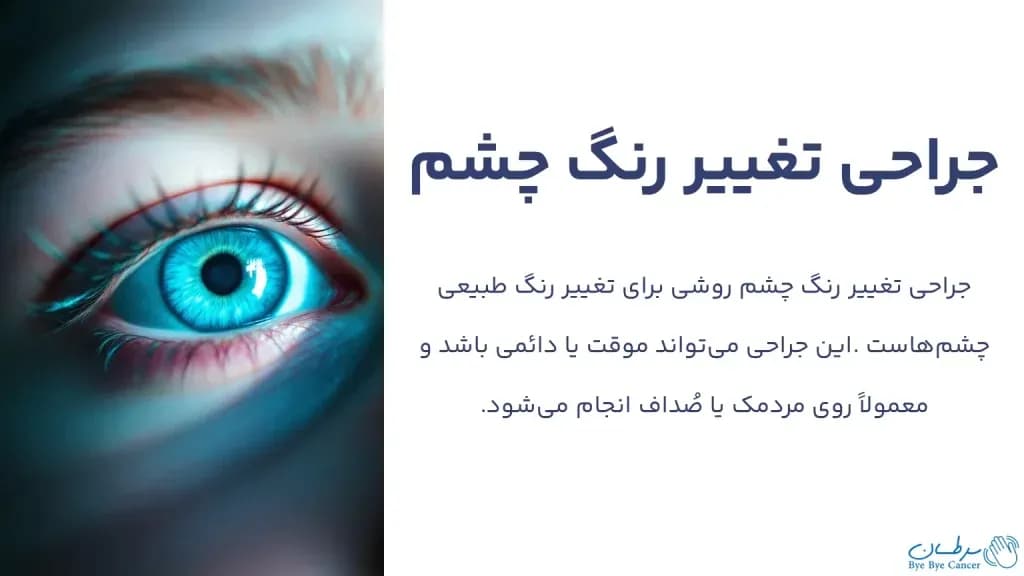 eye-color-change-surgery.1-1024x576.webp