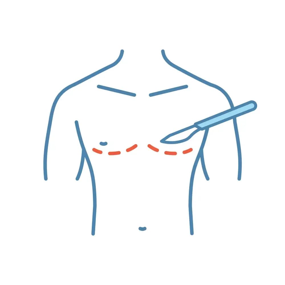 gynecomastia-and-cancer.webp