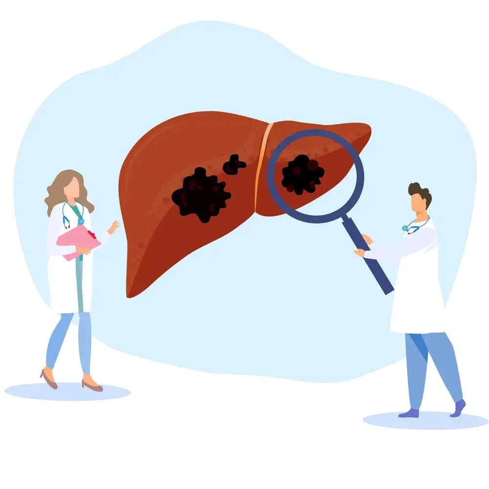 involved-in-liver-cancer.1.webp