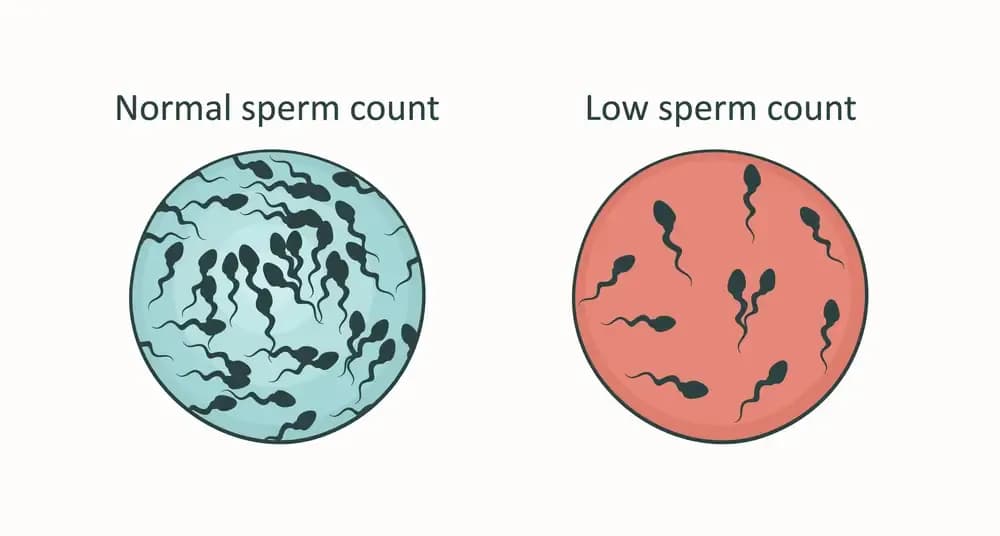 low-sperm-count-due-to-cancer.webp