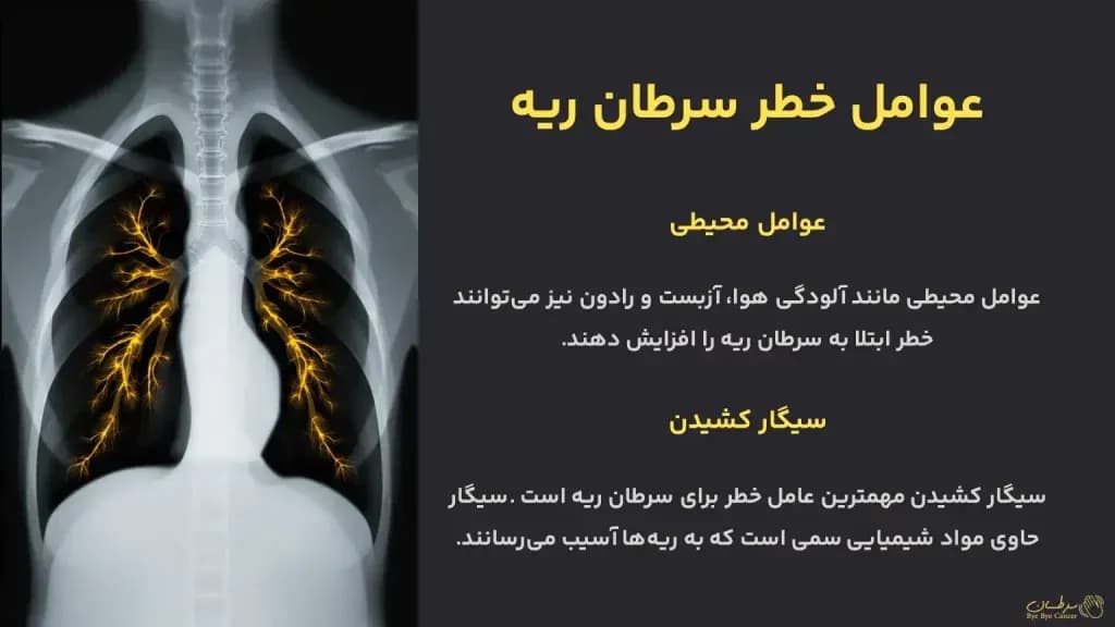 lung-cancer-risk-factors-1024x576.webp