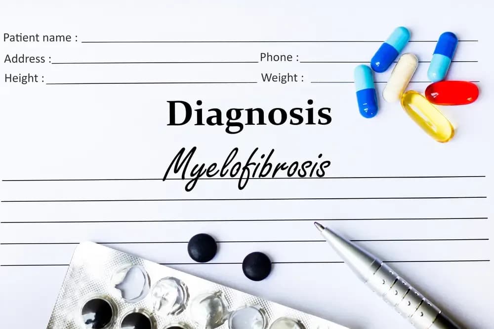 myelofibrosis-cancer.1.webp