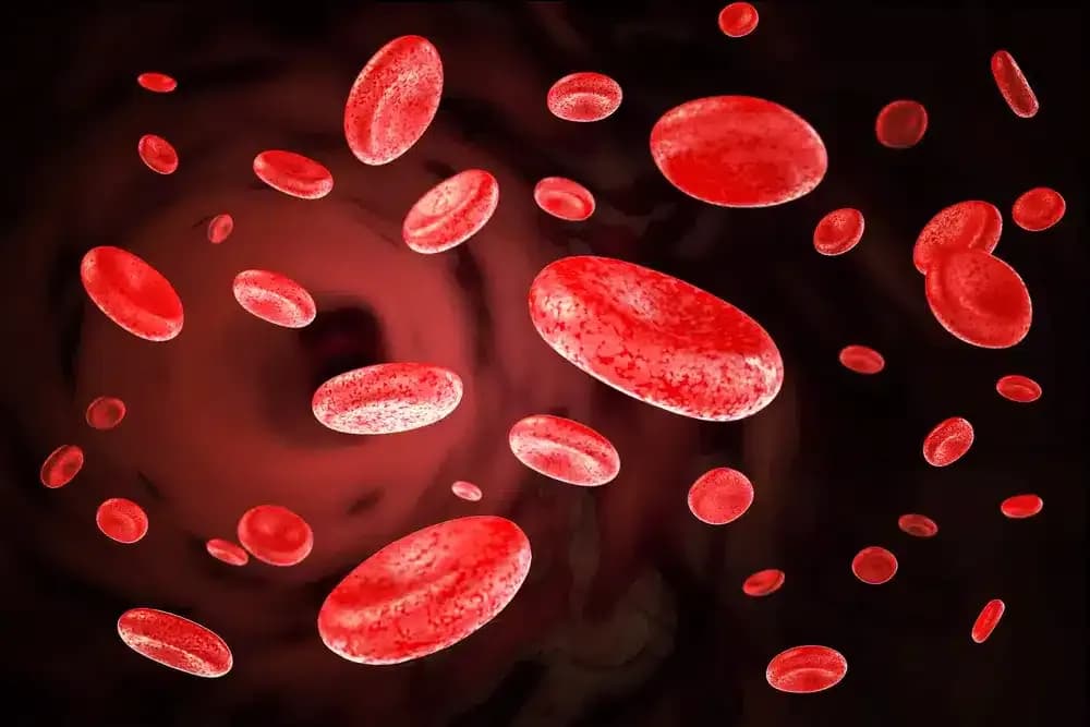 myelofibrosis.1.webp