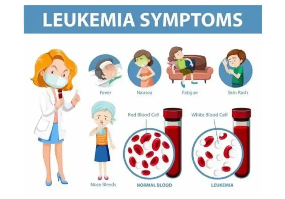 myeloid-leukemia.webp
